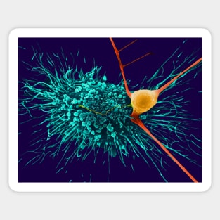 Astrocytic glial cell with cortical neuron, SEM (C032/0041) Sticker